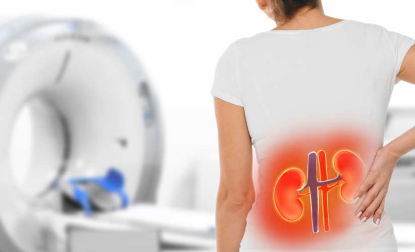 Chronic Kidney Disease (CKD)